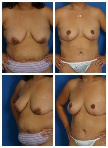 composite_16039610767512