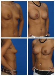 composite_16040472588674