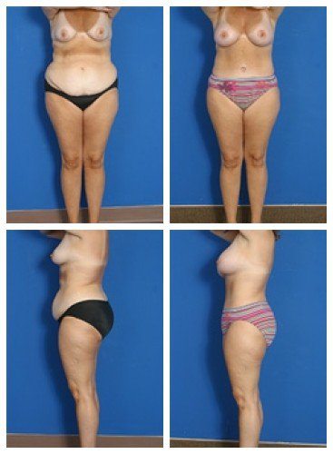 composite_16039611061560