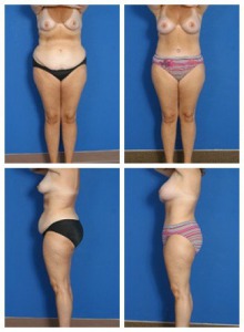 composite_16039611061560