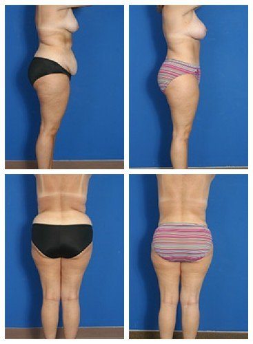 composite_16039611447523