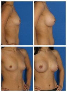 composite_16040473293873