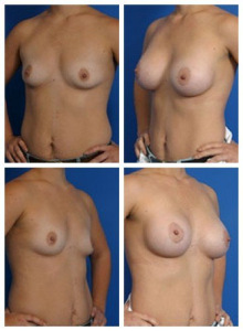 composite_16040473861512