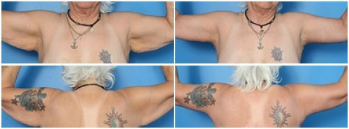 composite_16039698704326