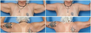Case 2