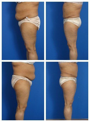 composite_16039701072887