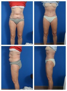 composite_16039701505024