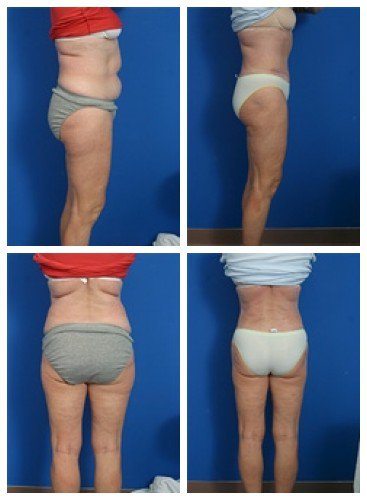 composite_16039701867830