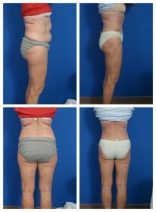 composite_16039701867830