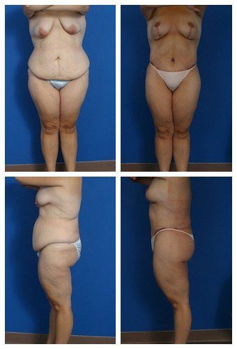 composite_16039613197388