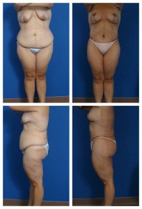 composite_16039613197388