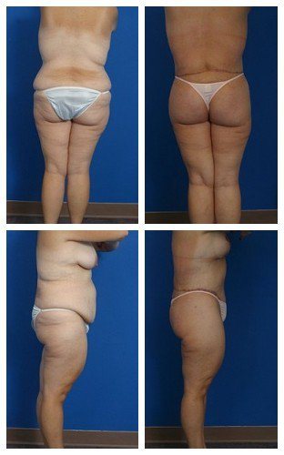 composite_16039613664486