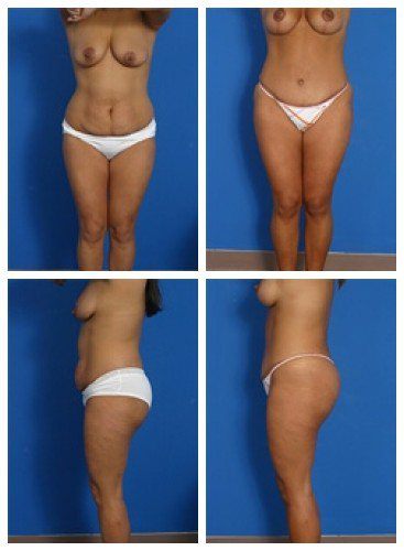 composite_16039587446439