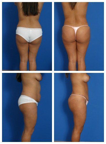 composite_16039587919850