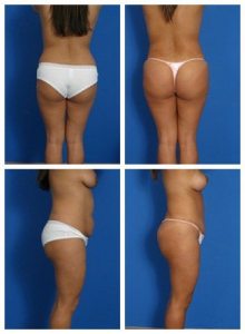 composite_16039587919850