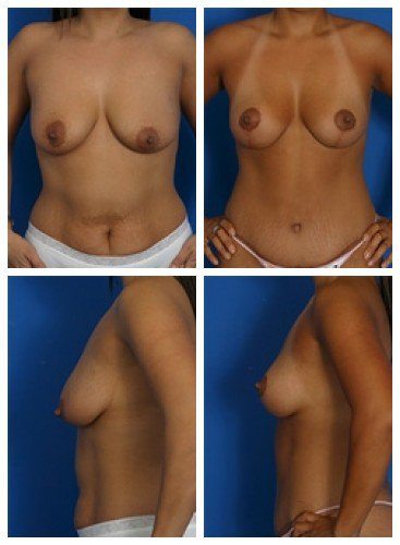 composite_16039588185207