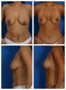 composite_16039588185207