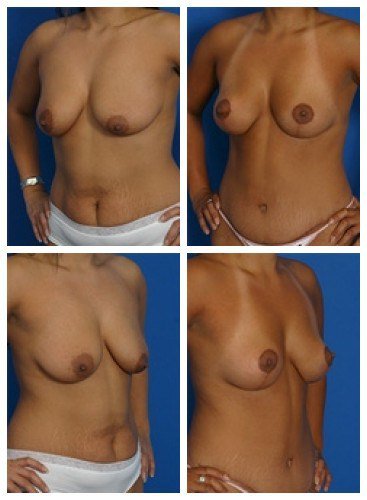 composite_16039588558238