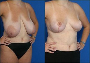 composite_16039635502534