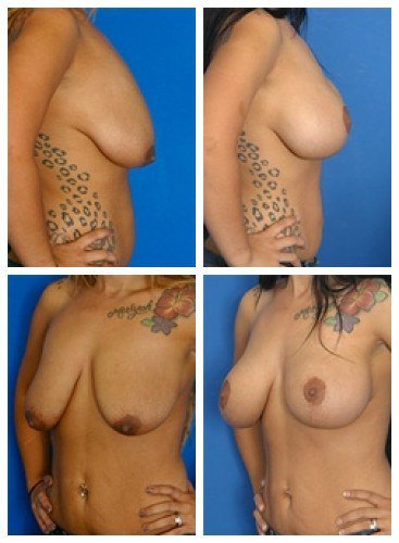 composite_16039780419934