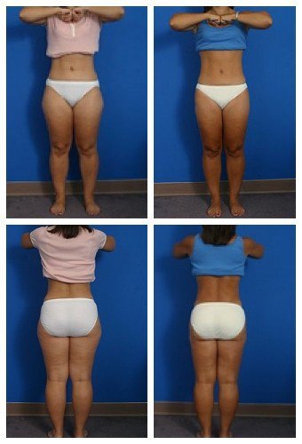 composite_16039621068928