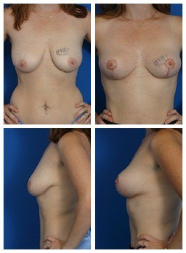 composite_16039787628903