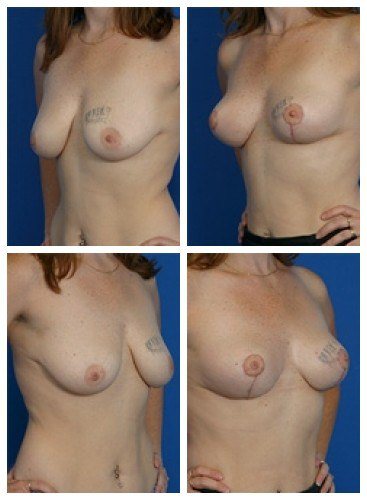 composite_16039787948983