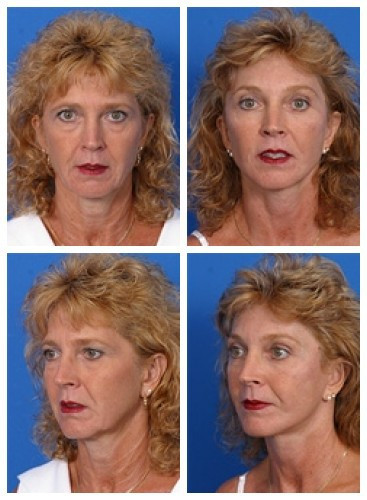 composite_16038893486247