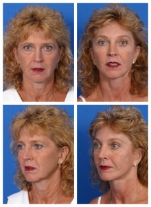 composite_16038893486247