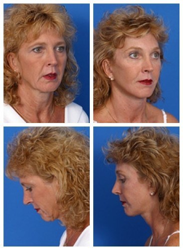 composite_16038893936603