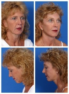 composite_16038893936603