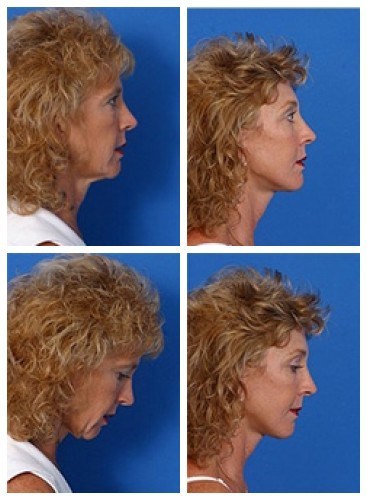 composite_16038894265452