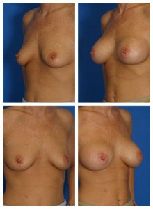 composite_16040474977371