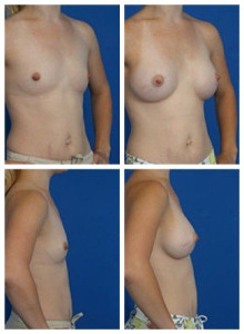 composite_16040475639392