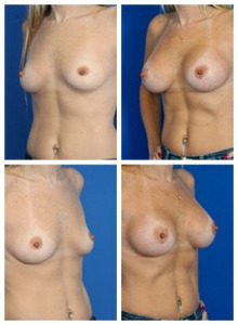 composite_16040476159152