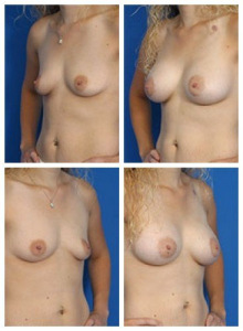 composite_16040477407865