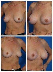 composite_16040478382004