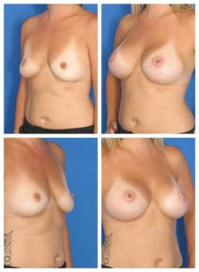 composite_16040479365874