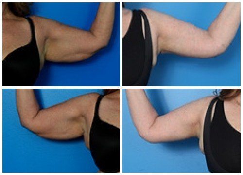 composite_16039699124012