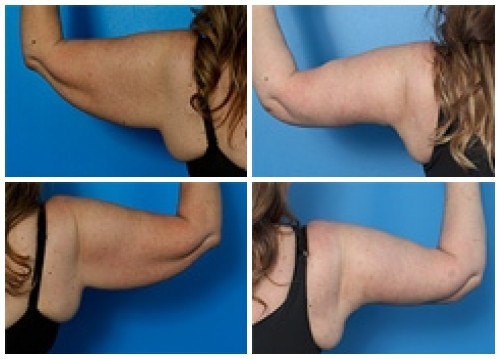 composite_16039699602894