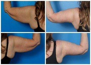 composite_16039699602894