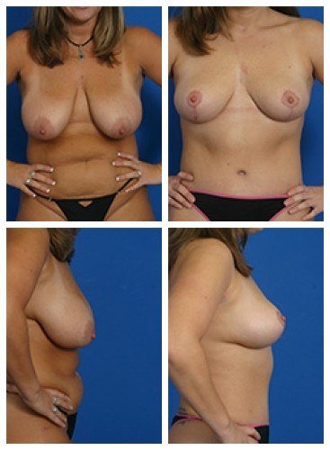 composite_16039588945081