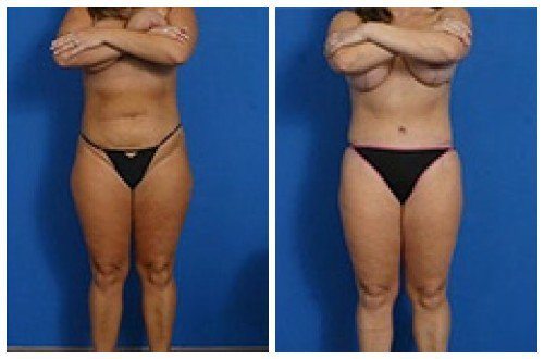 composite_16039590042356