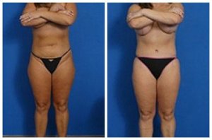 composite_16039590042356