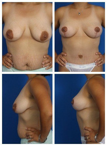 composite_16039788452254