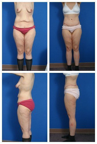 composite_16039615126349