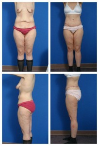 composite_16039615126349