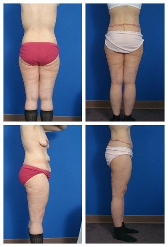 composite_16039615739187