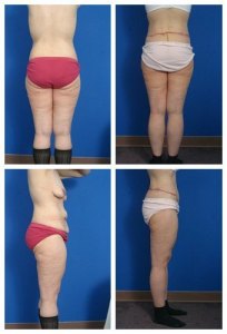 composite_16039615739187