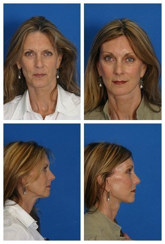 composite_16038897612407